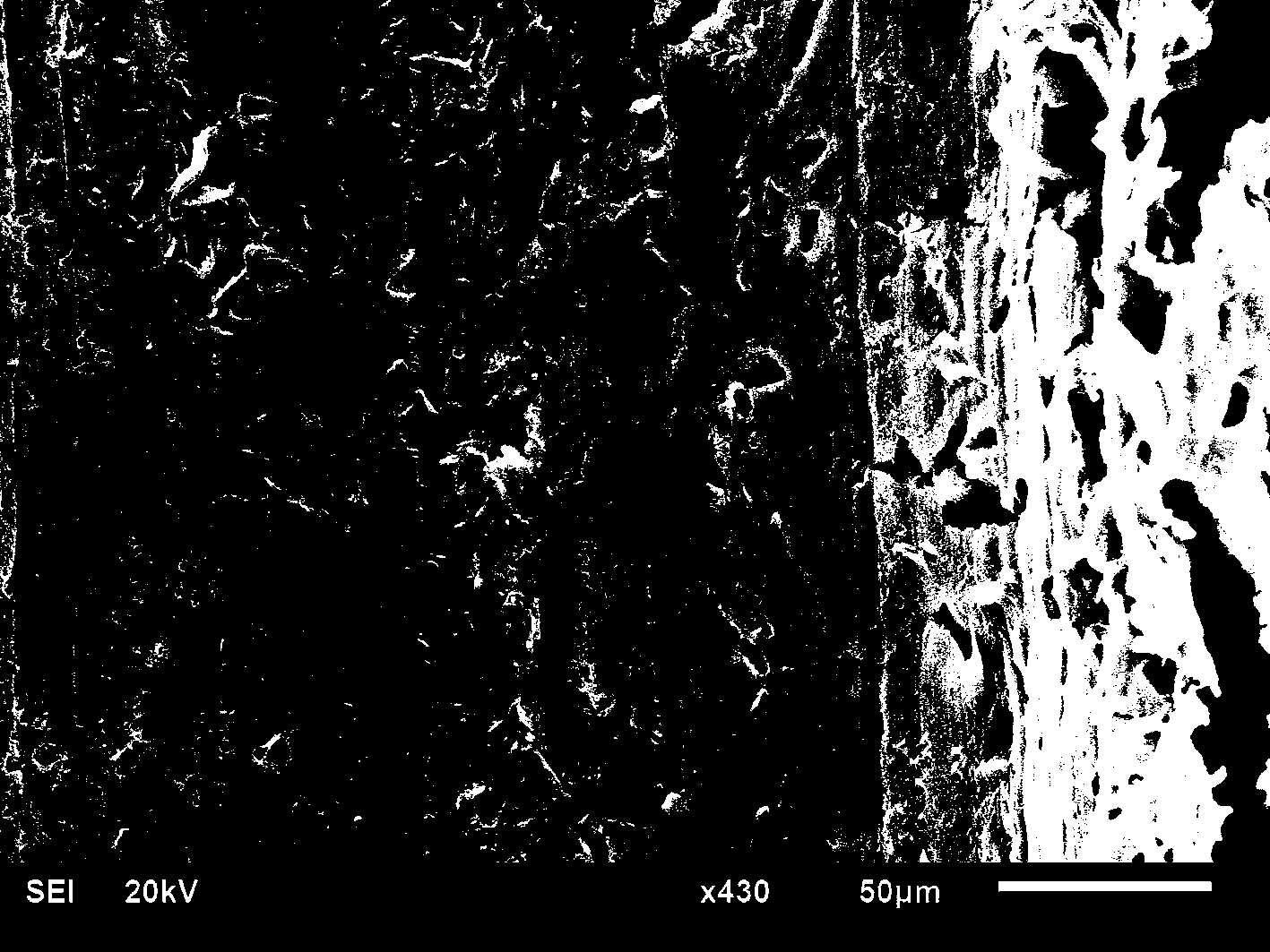 Preparation method of bone repair bracket with osteoid poriform regeneration channel structure