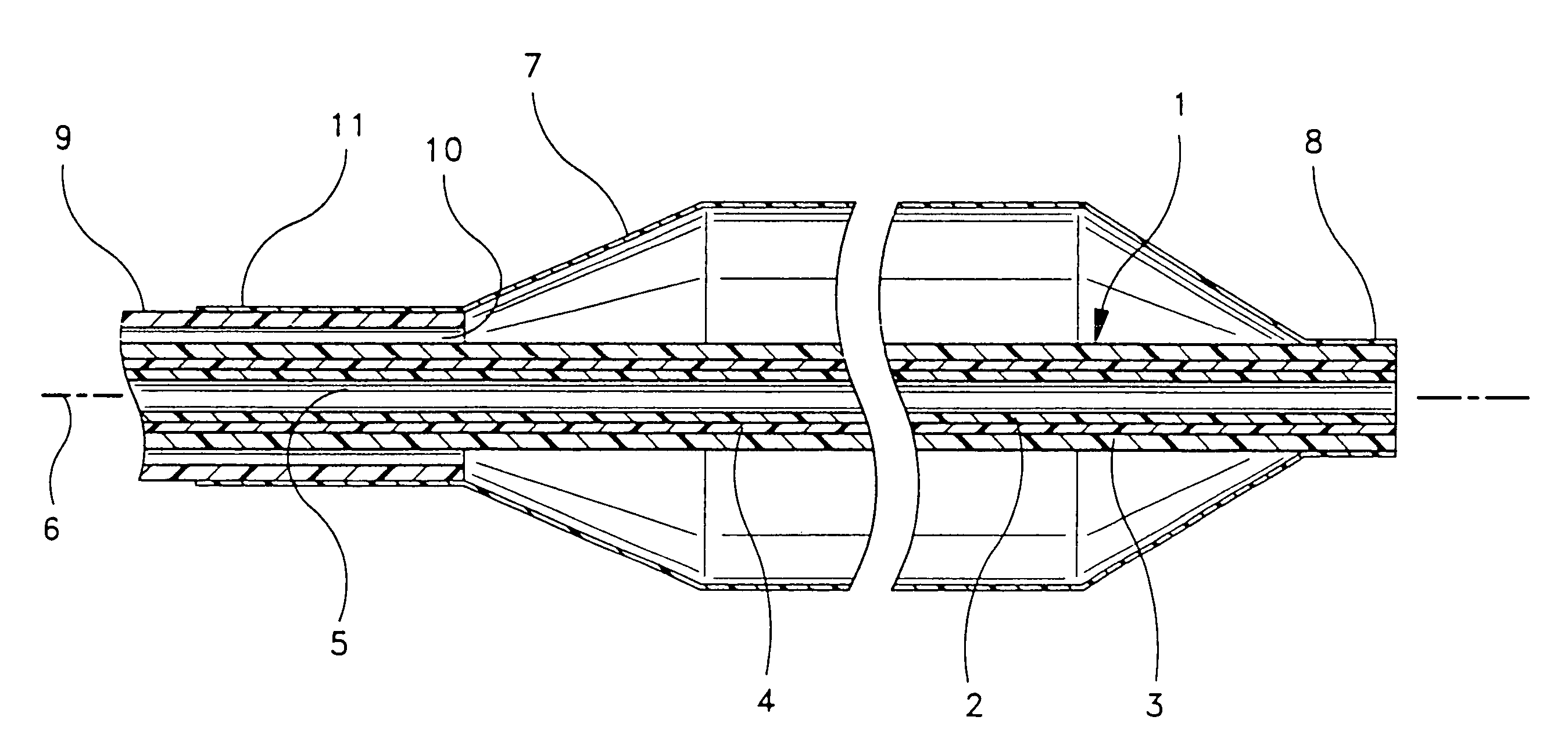 Multilayer interventional catheter