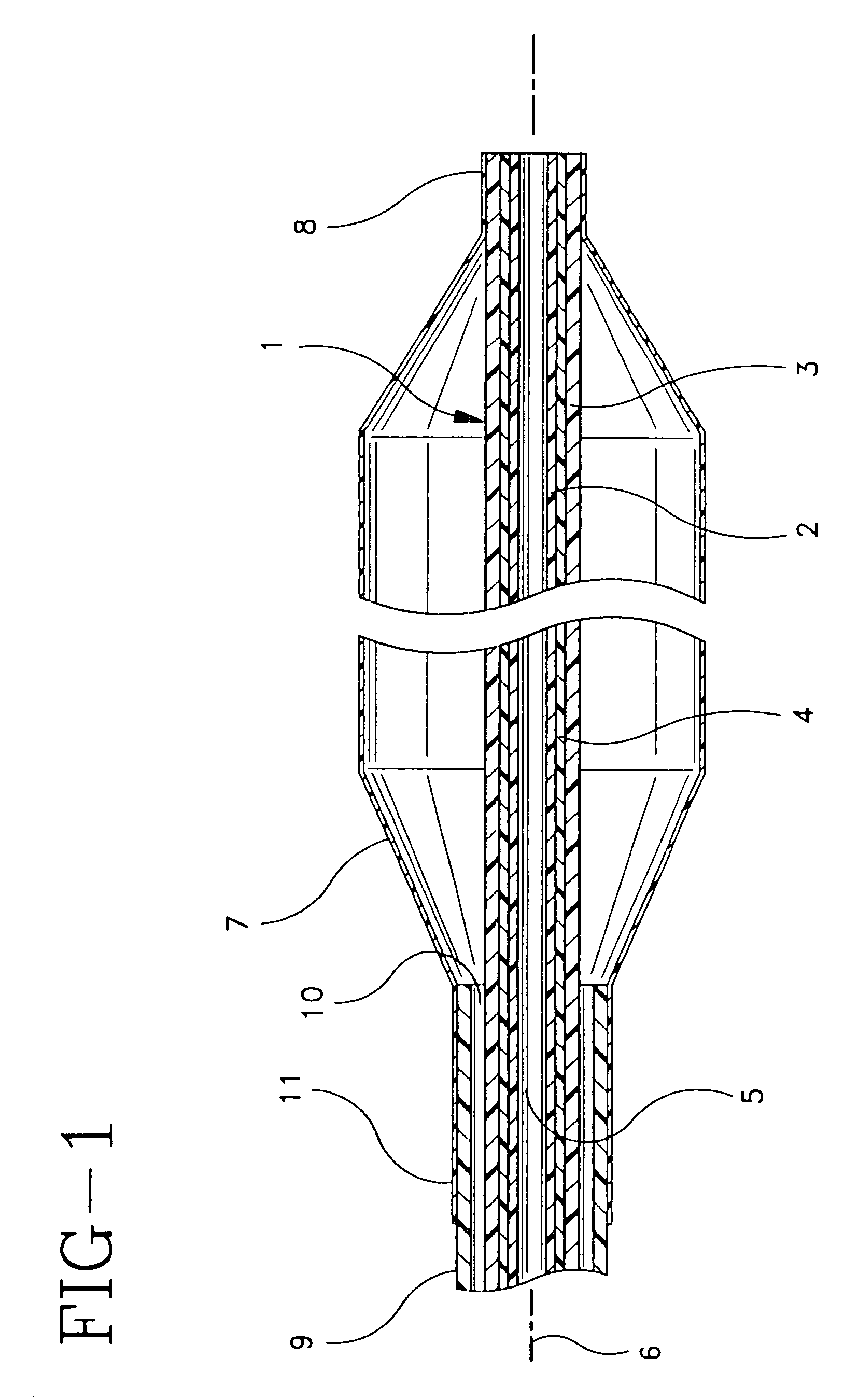 Multilayer interventional catheter