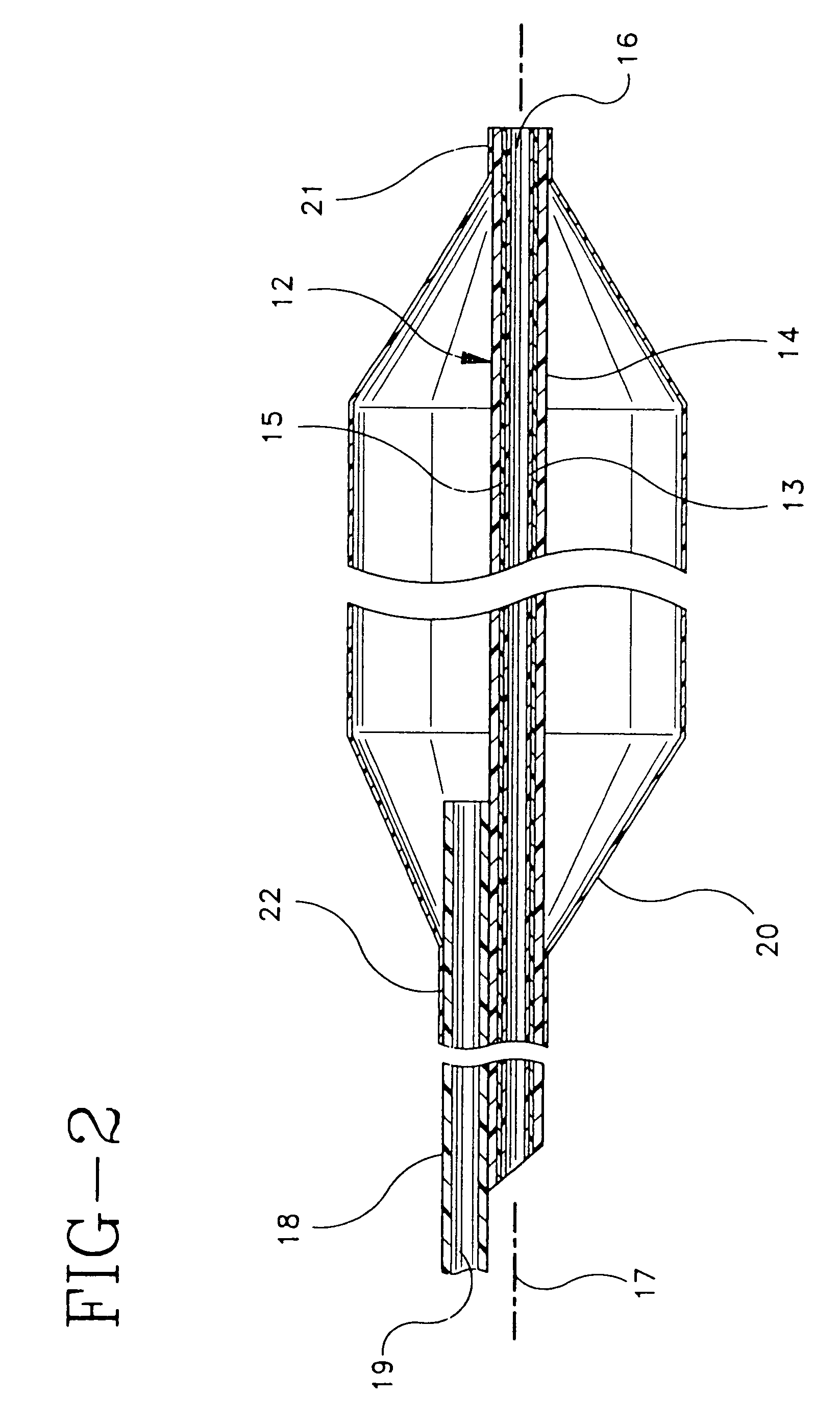 Multilayer interventional catheter