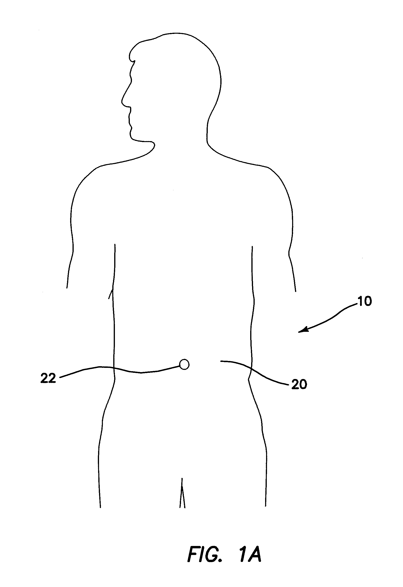 Surgical access device comprising internal retractor