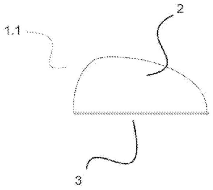 Container device for breast prosthesis for breast reconstruction surgery