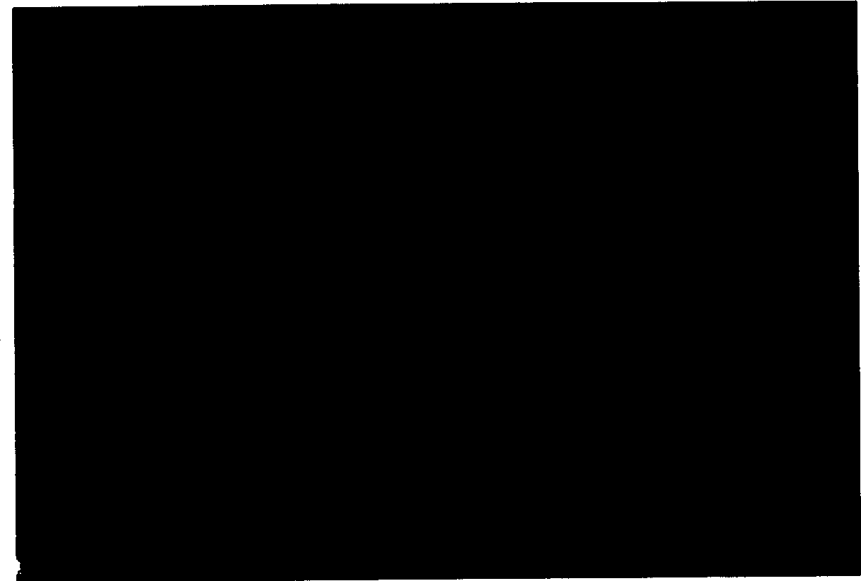 Preprartion method of improved hepatoma murine monoclonal antibody