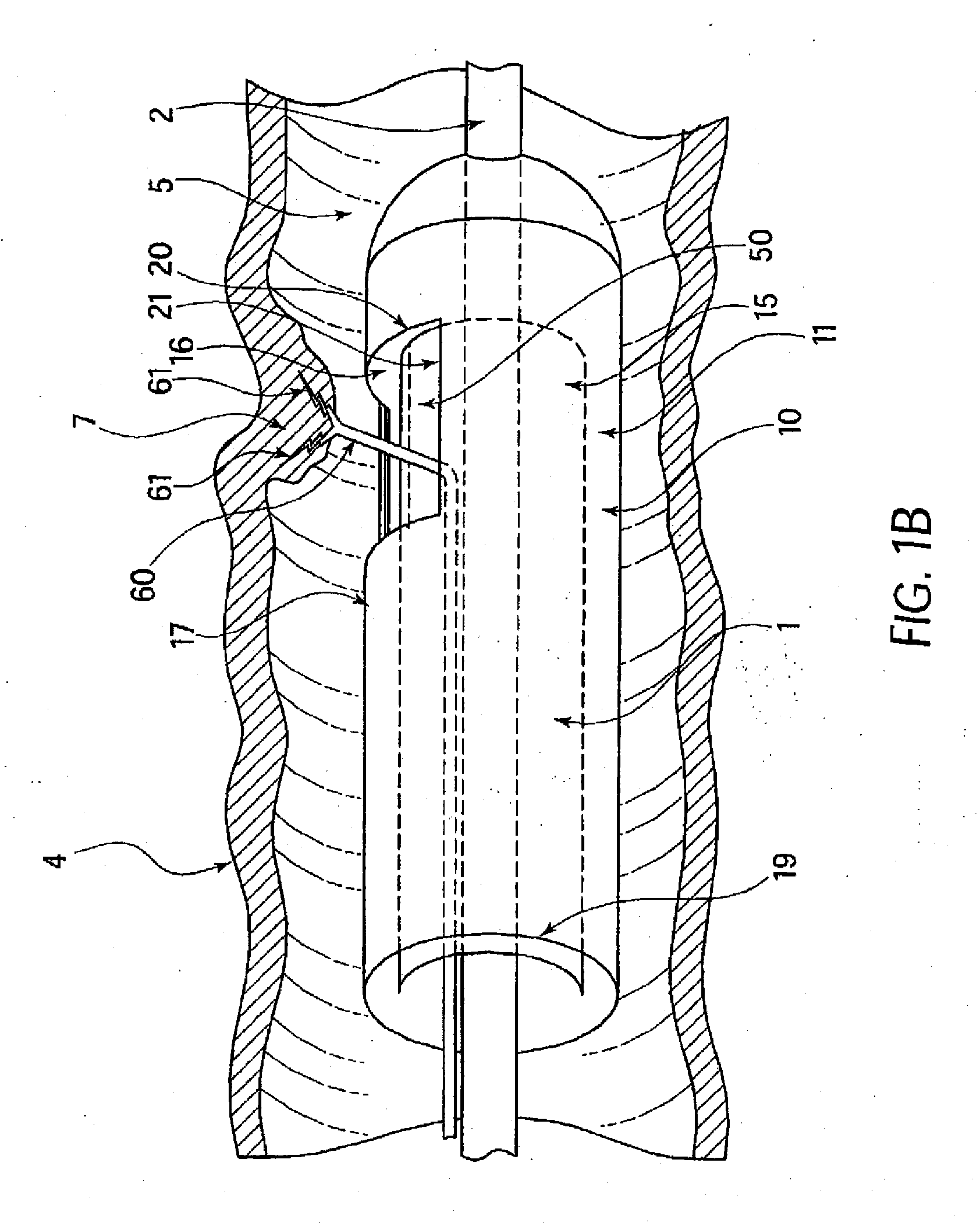 Stapling and Cutting in Resectioning for Full Thickness Resection Devices