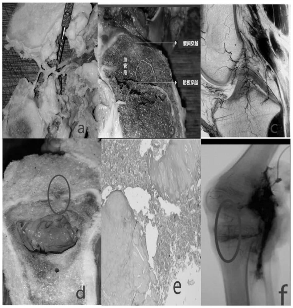 Magnetofluid composite developing agent and application thereof in field of intraosseous angiography