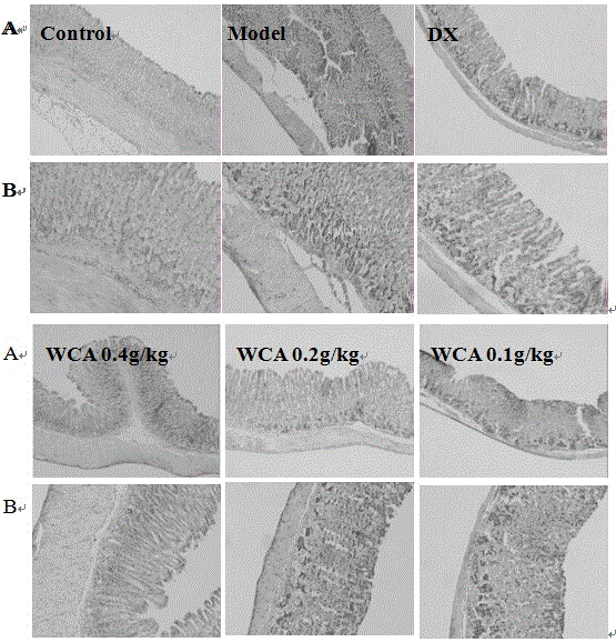 Application of Weichangan to preparation of alcoholic gastric ulcer resistant drugs