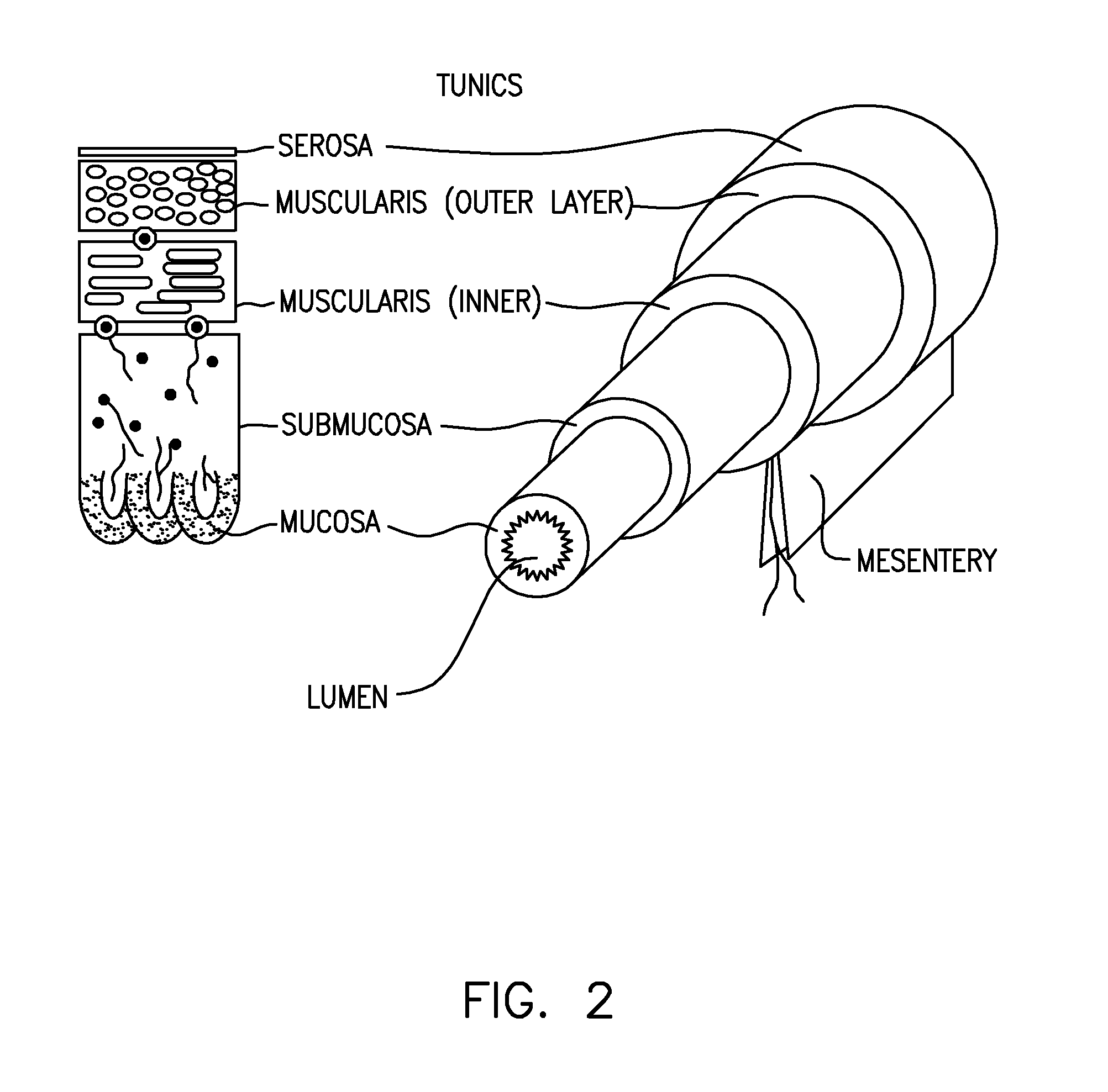 Methods And Apparatus For The Treatment Of Metabolic Disorders