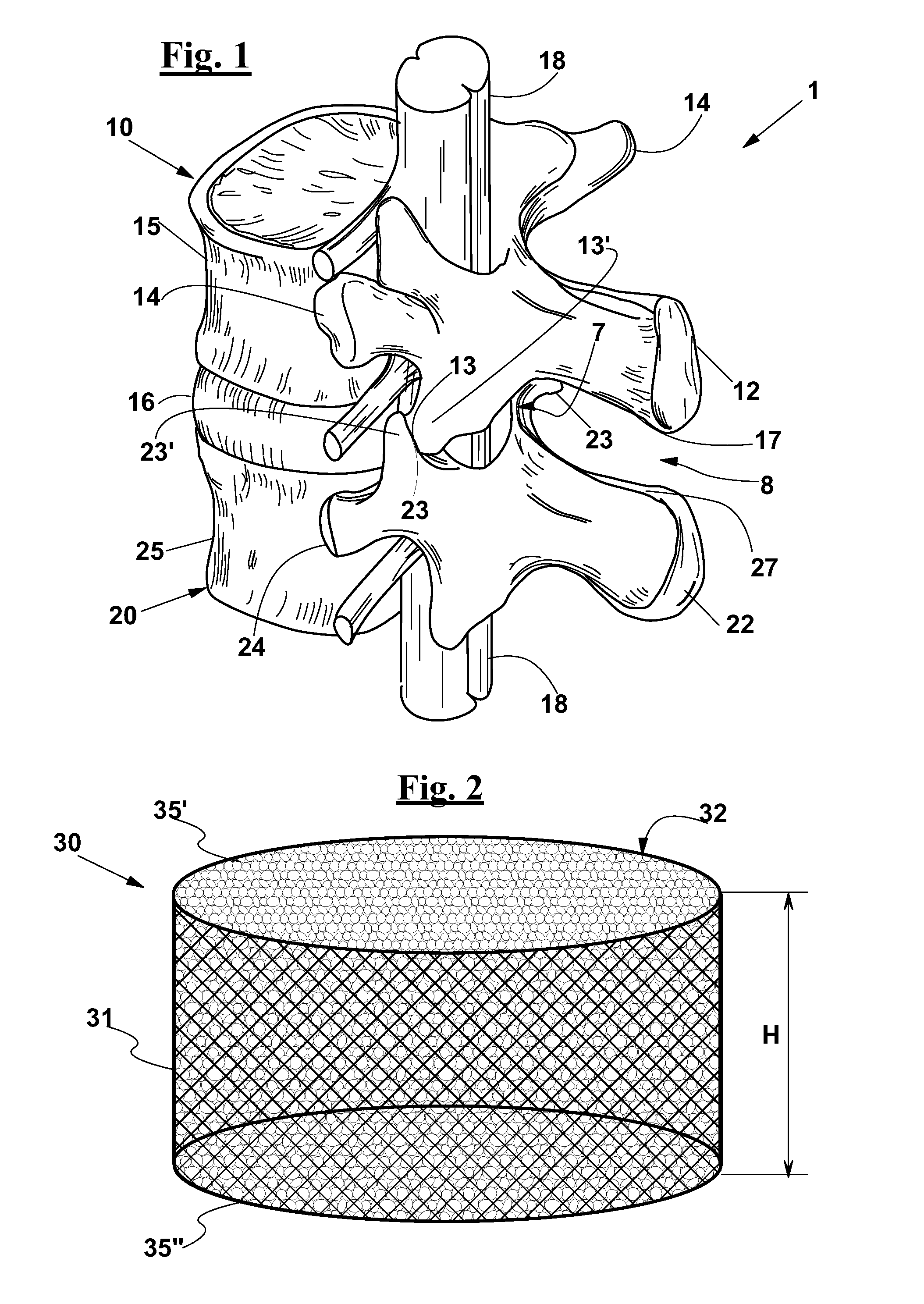 Vertebral fusion device and system