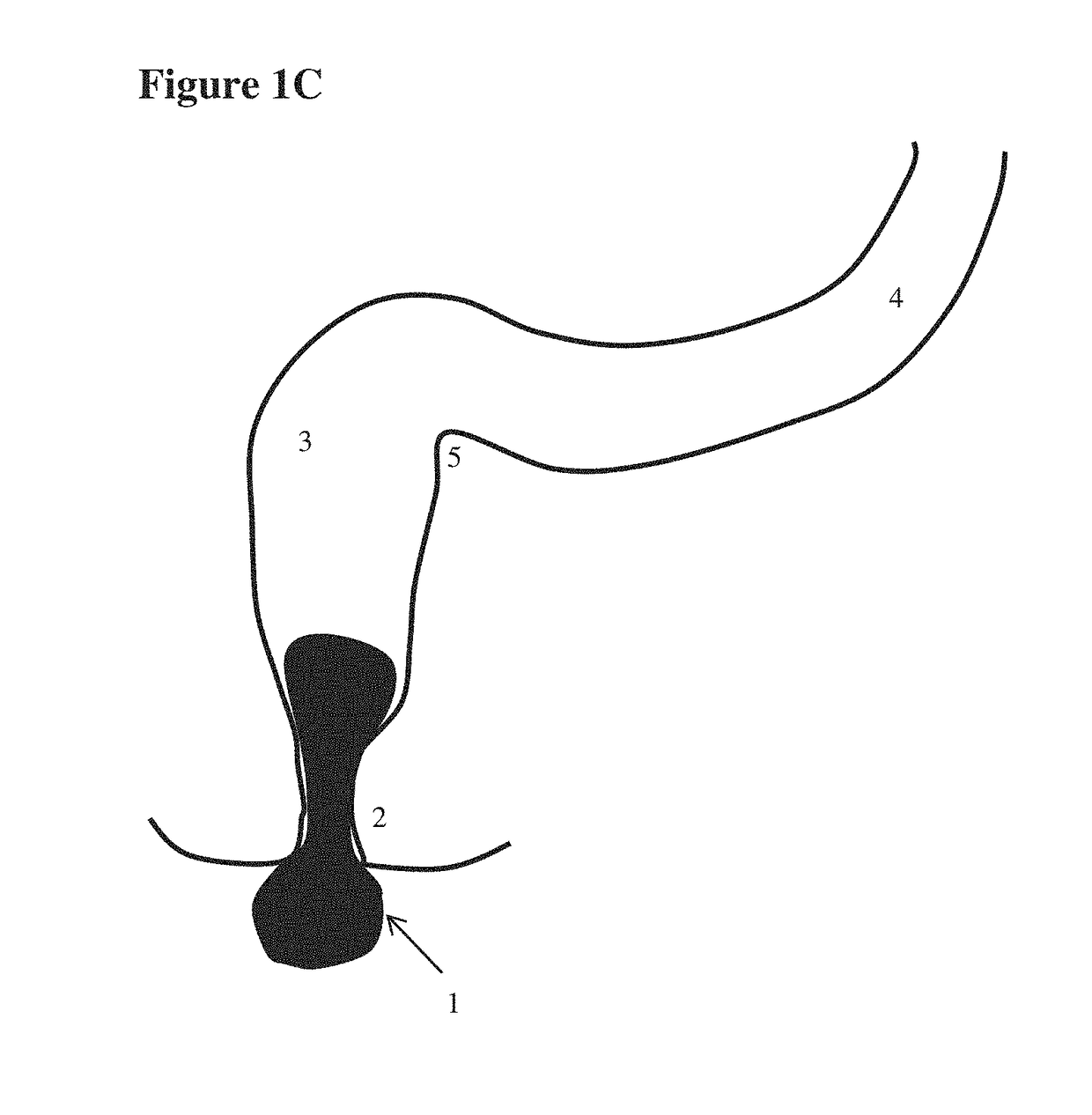 Devices for testing distal colonic and anorectal function