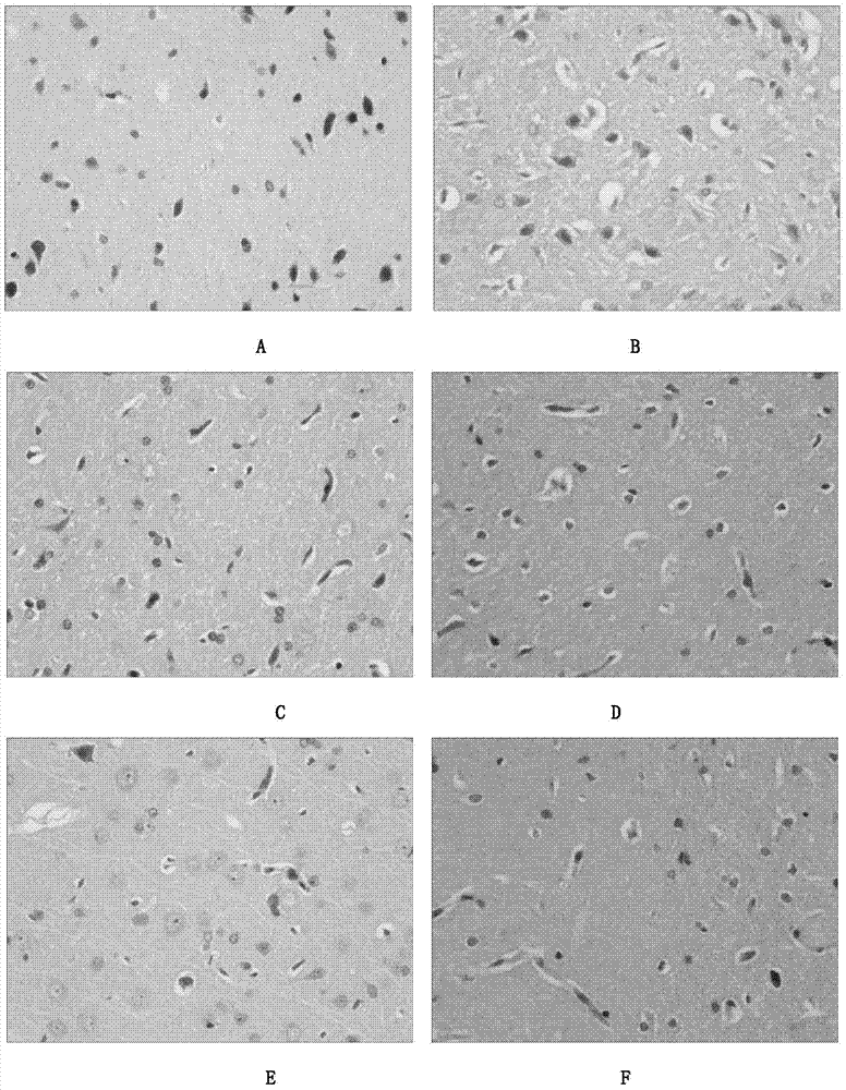 Application of cistanche phenylethanoid glycoside extractive to control altitude sickness