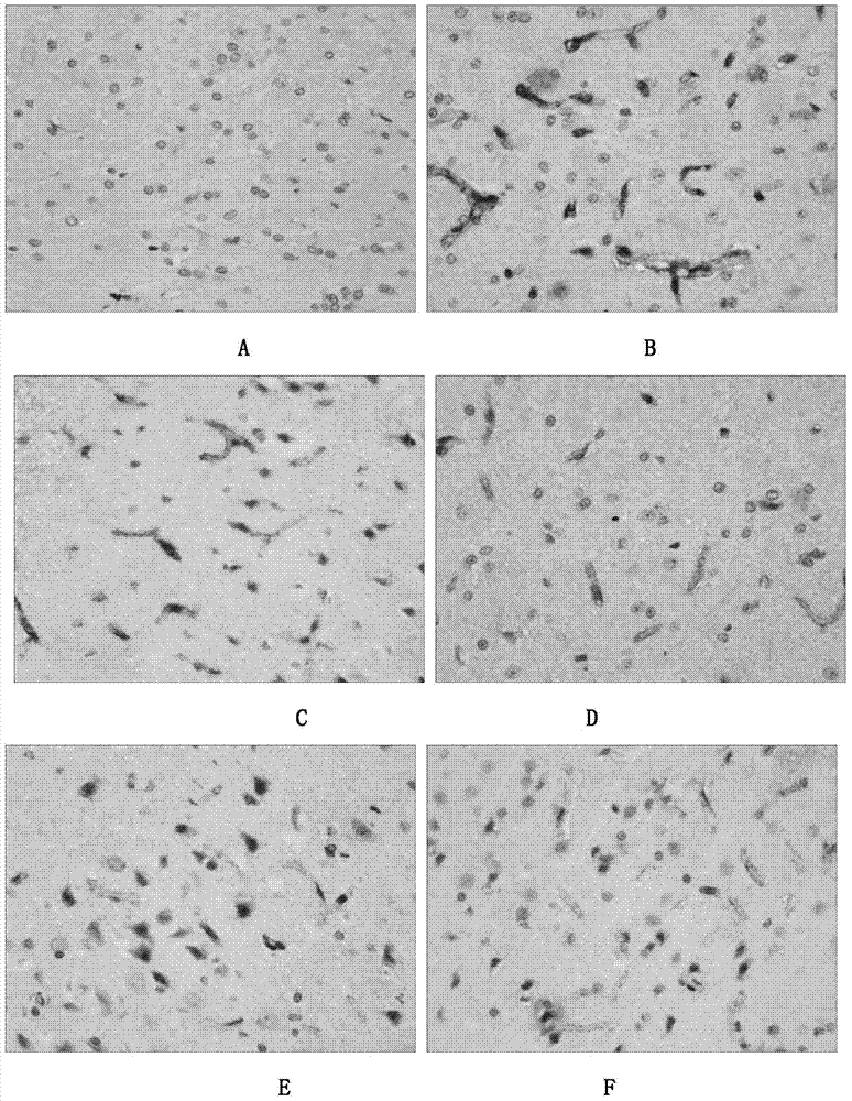 Application of cistanche phenylethanoid glycoside extractive to control altitude sickness