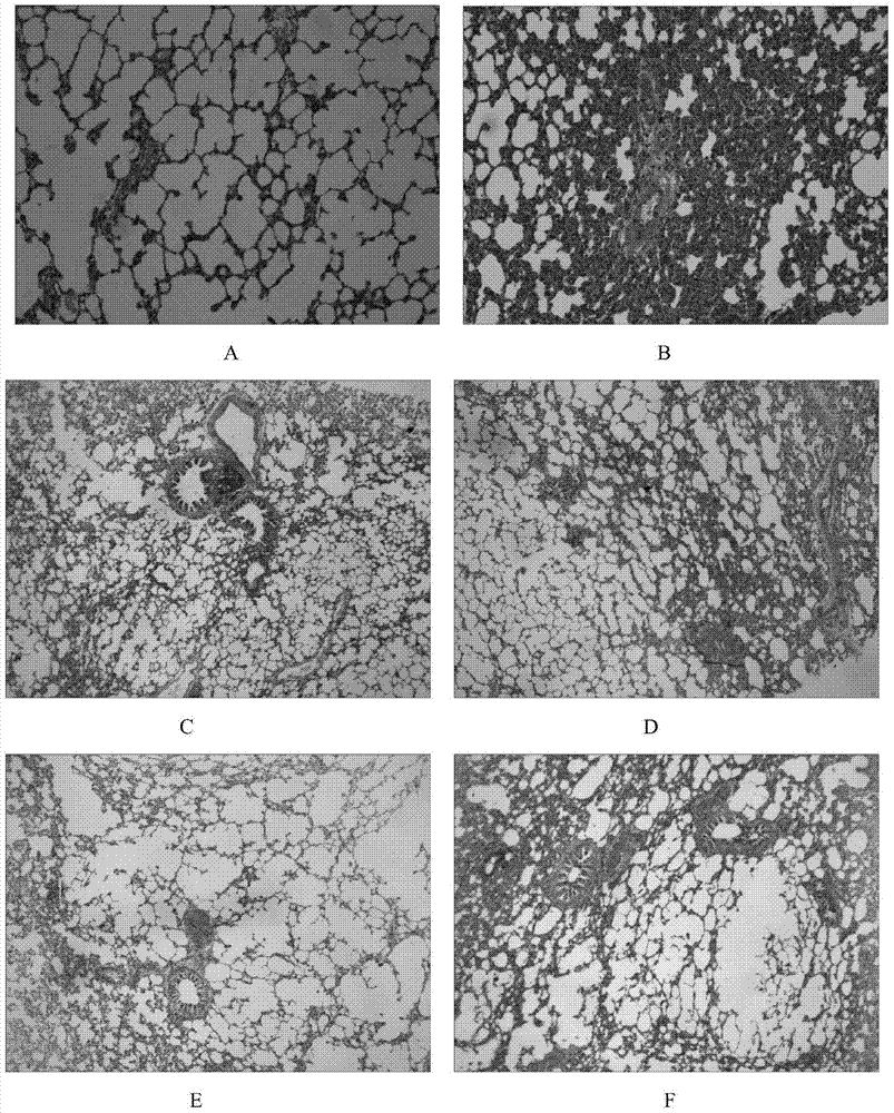 Application of cistanche phenylethanoid glycoside extractive to control altitude sickness