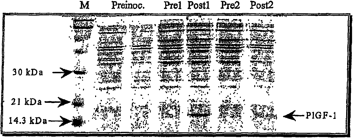 Process for preparing recombined placental growth factor