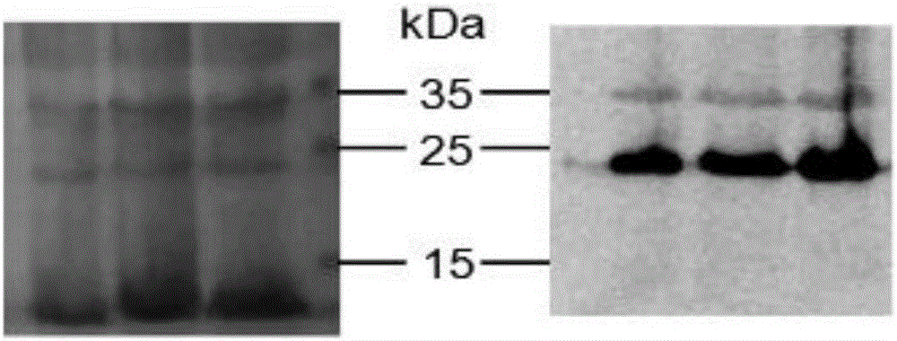 Recombinant interferon lambda 4 encoded cDNA sequence as well as preparation method and application thereof