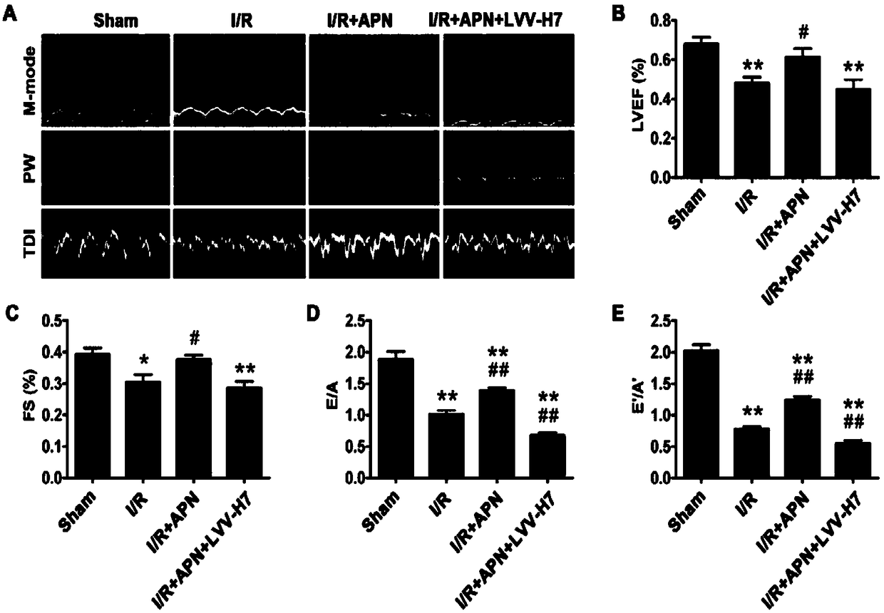 Pharmaceutical composition for treating and/or preventing myocardial ischemia-reperfusion injury, and its preparation method