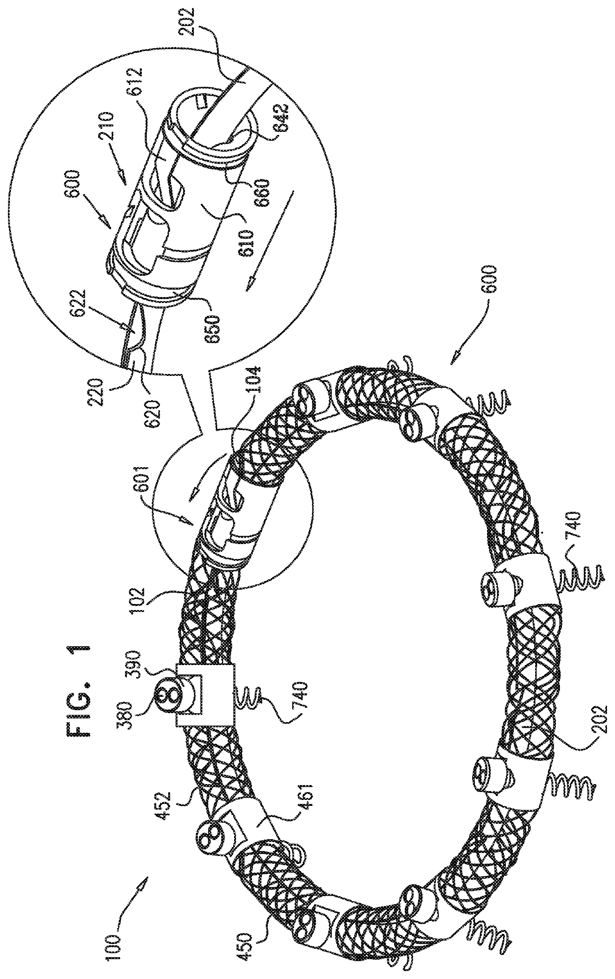 Implantation of repair devices in the heart