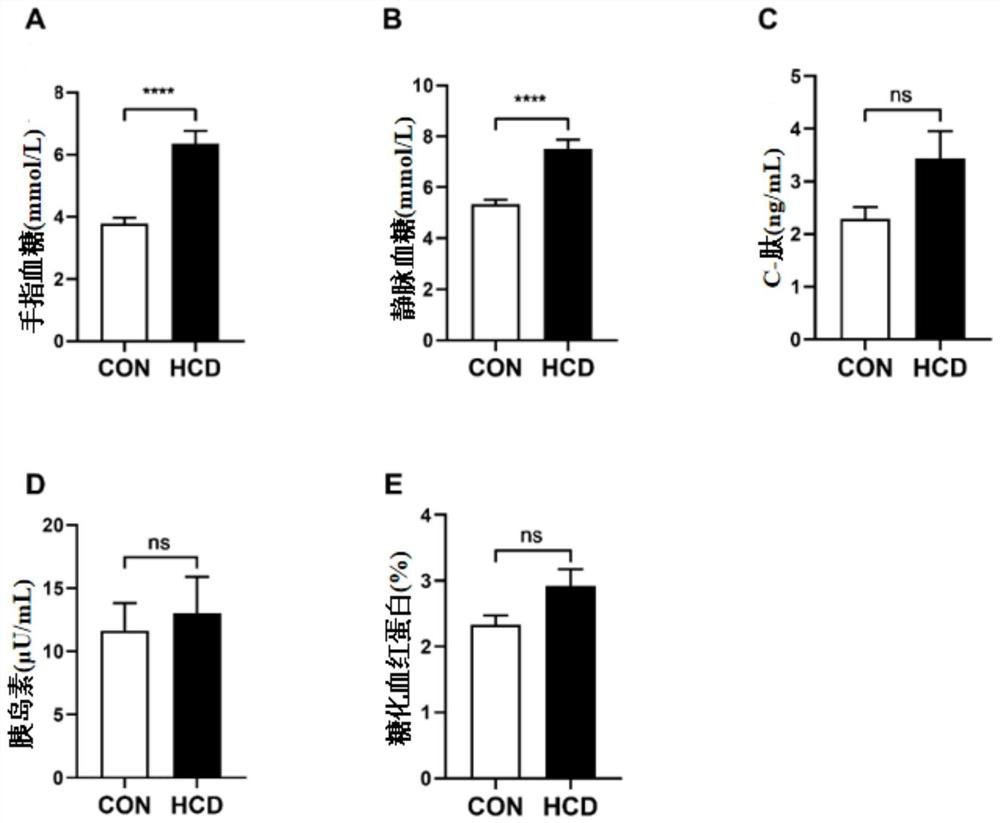 Establishment method and application of machin type 2 diabetes model