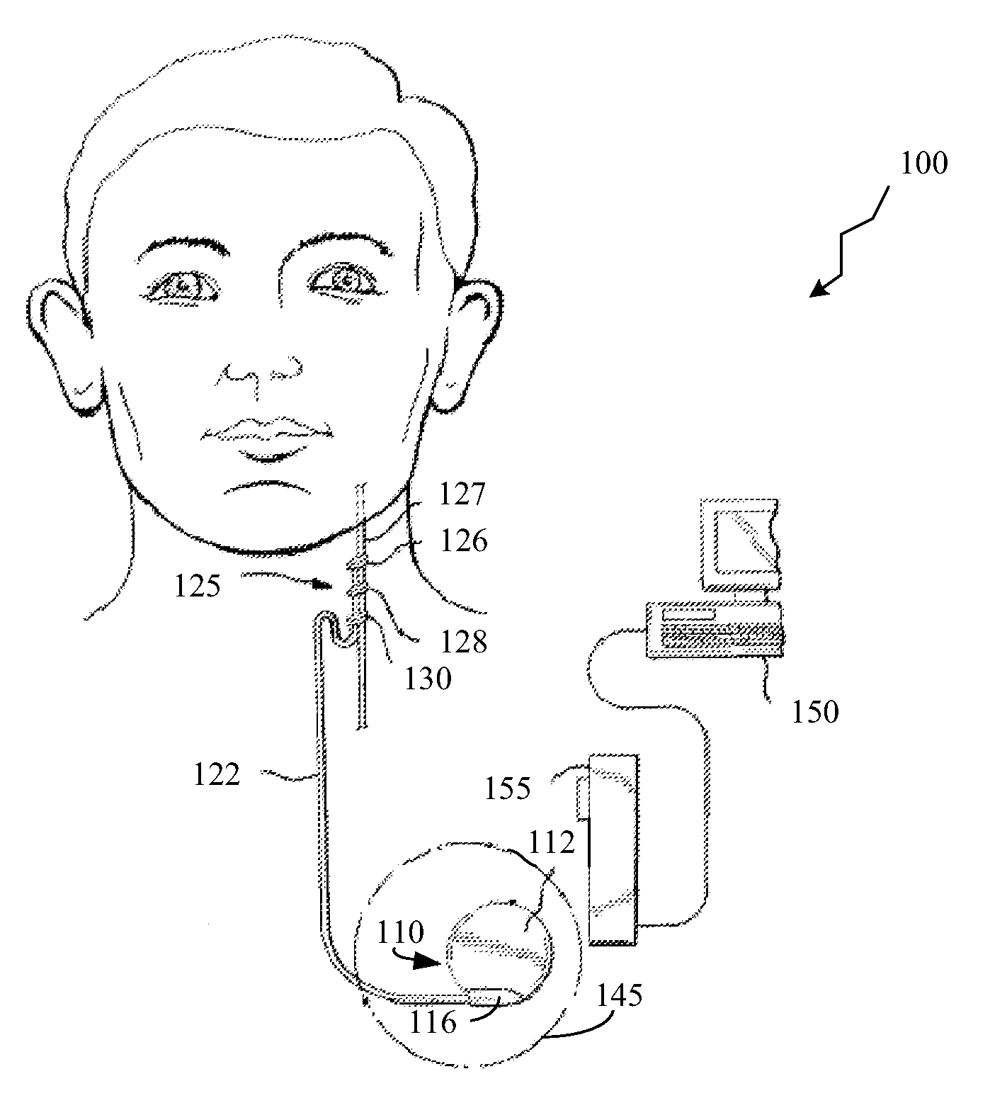 Detecting, quantifying, and/or classifying seizures using multimodal data