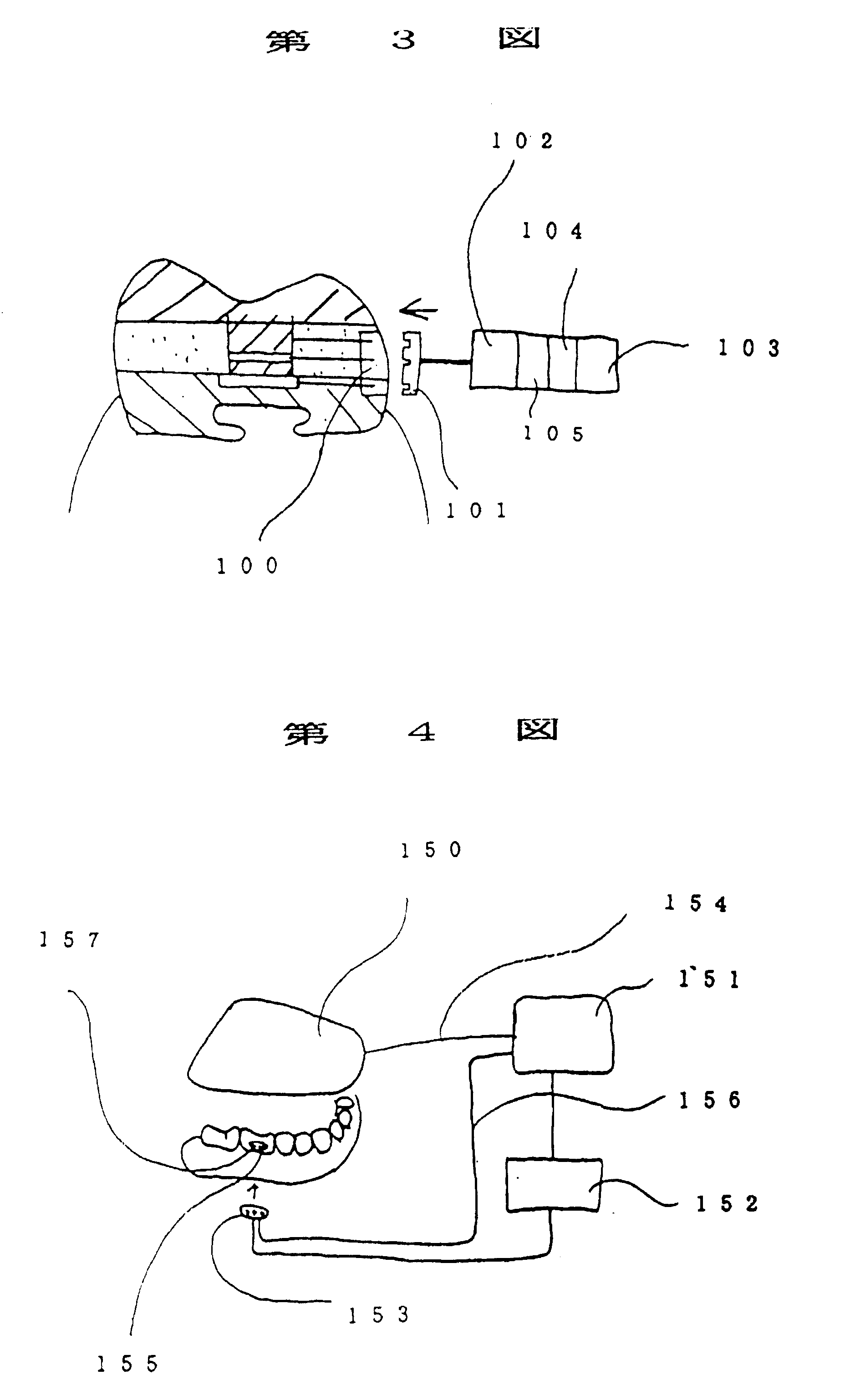 Artificial tooth and controller