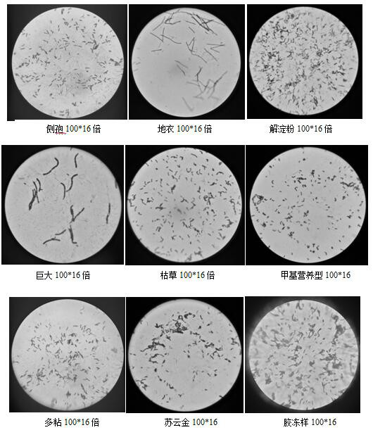 Compound microbial agent for improving phosphorus utilization rate