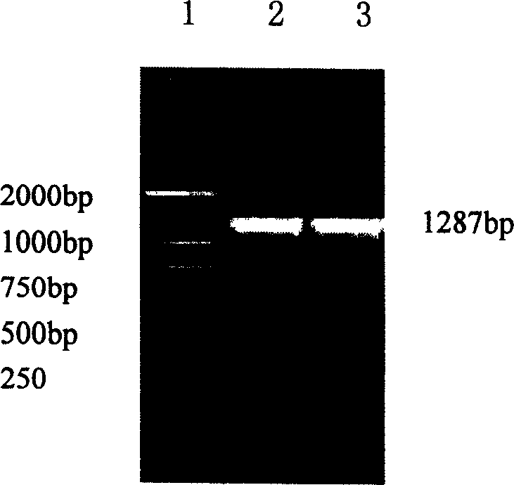 Method for detecting nephrotic syndrome hemorrhagic fever antibody