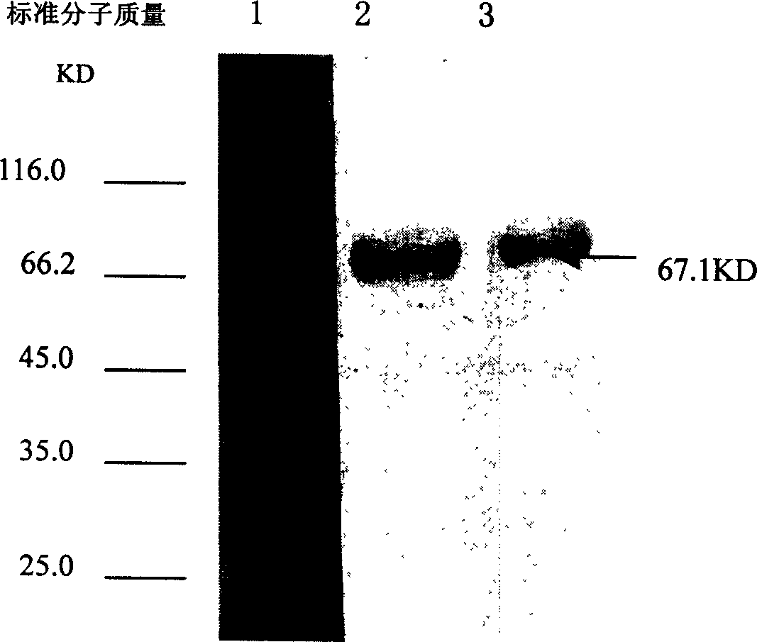 Method for detecting nephrotic syndrome hemorrhagic fever antibody