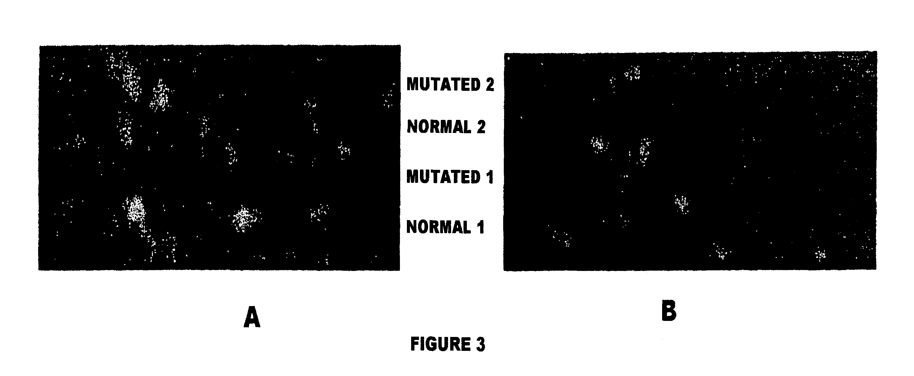 Method and device for the detection of mutations in isolated gene sequences of the low-density lipoprotein receptor (LDL-r) which is associated with familial hypercholesterolemia