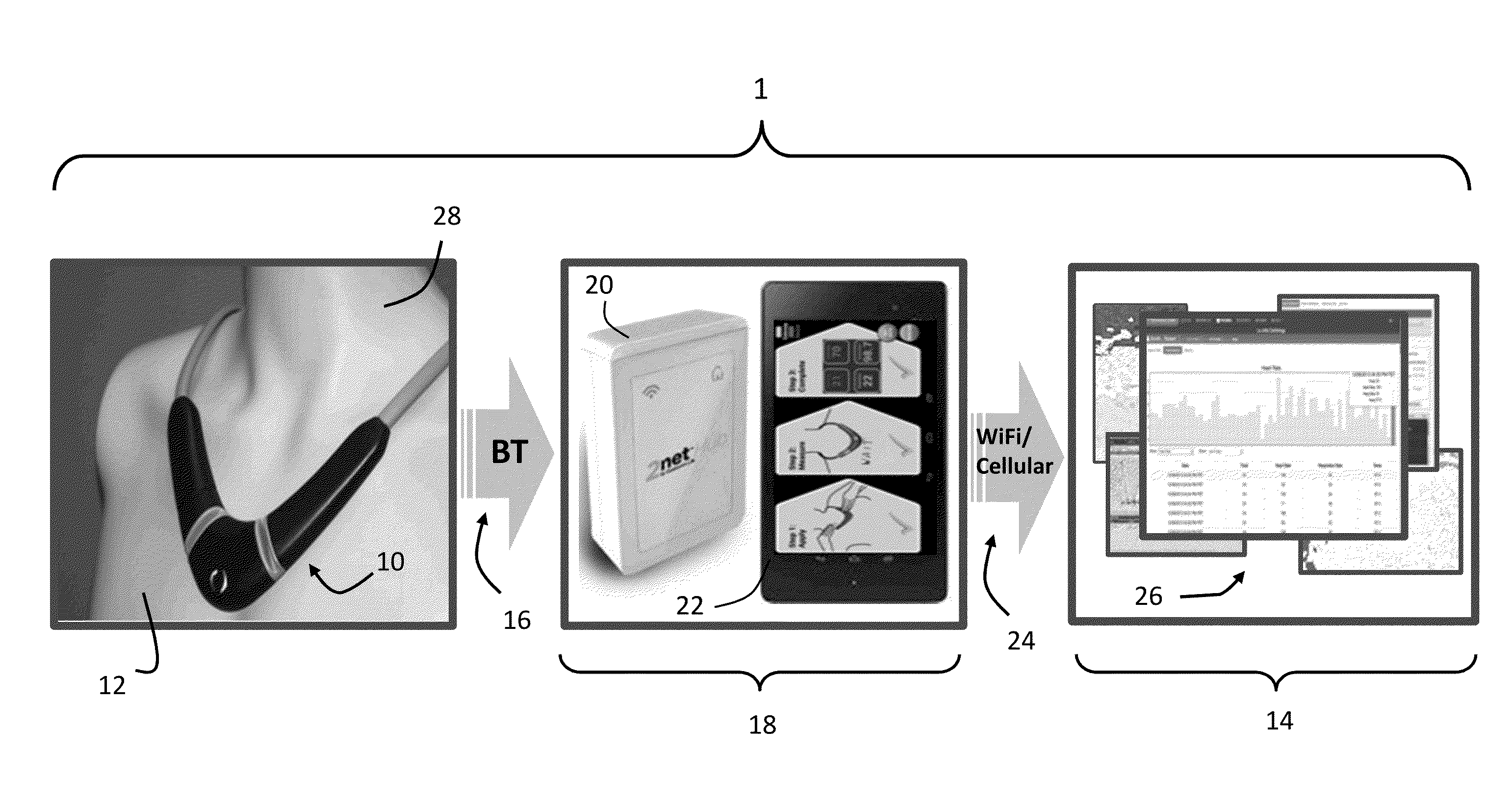 Neck-worn physiological monitor