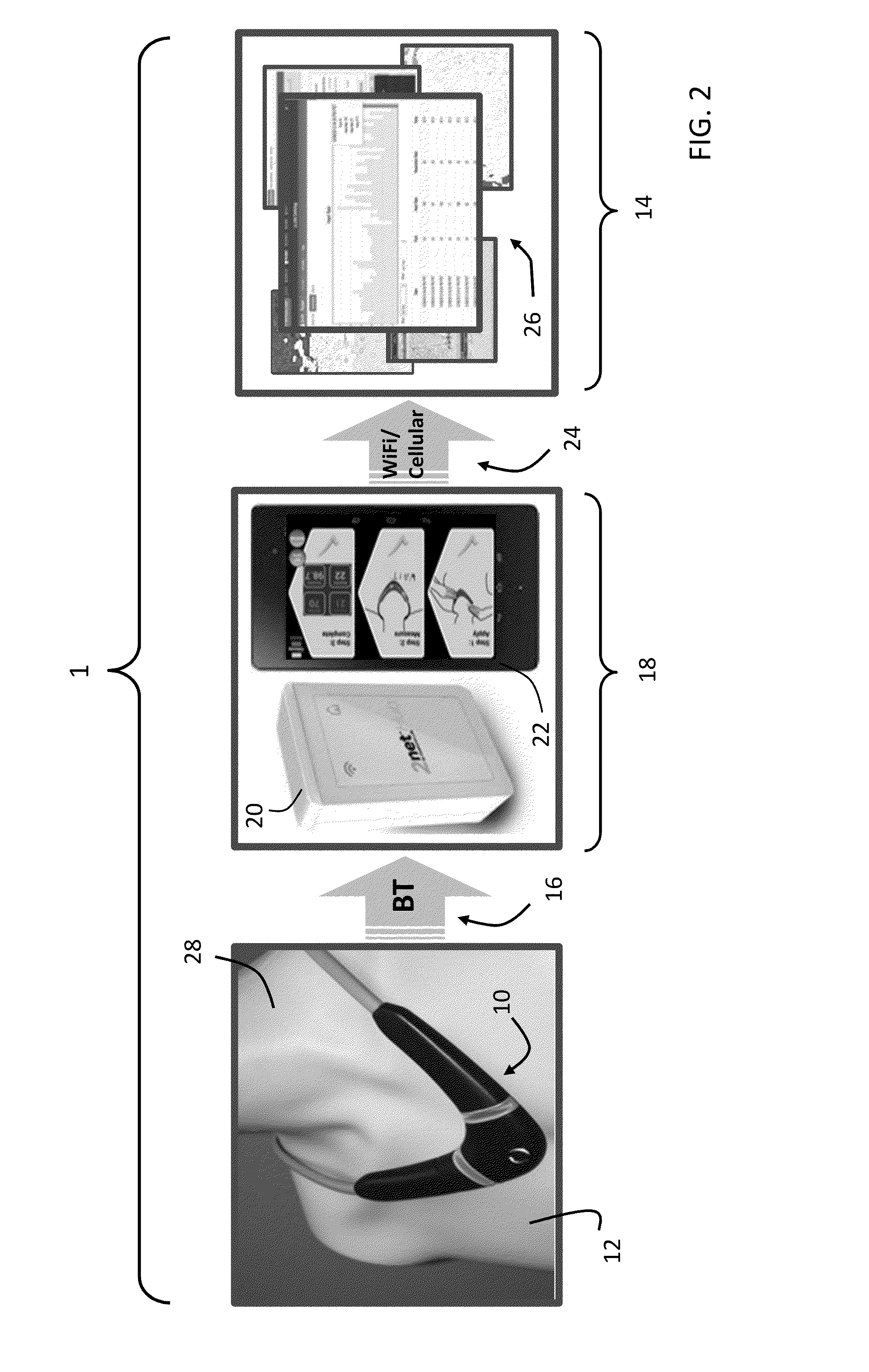 Neck-worn physiological monitor