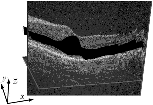 OCT (Optical Coherence Tomography) image layer segmentation method based on neural network and constraint graph search algorithm