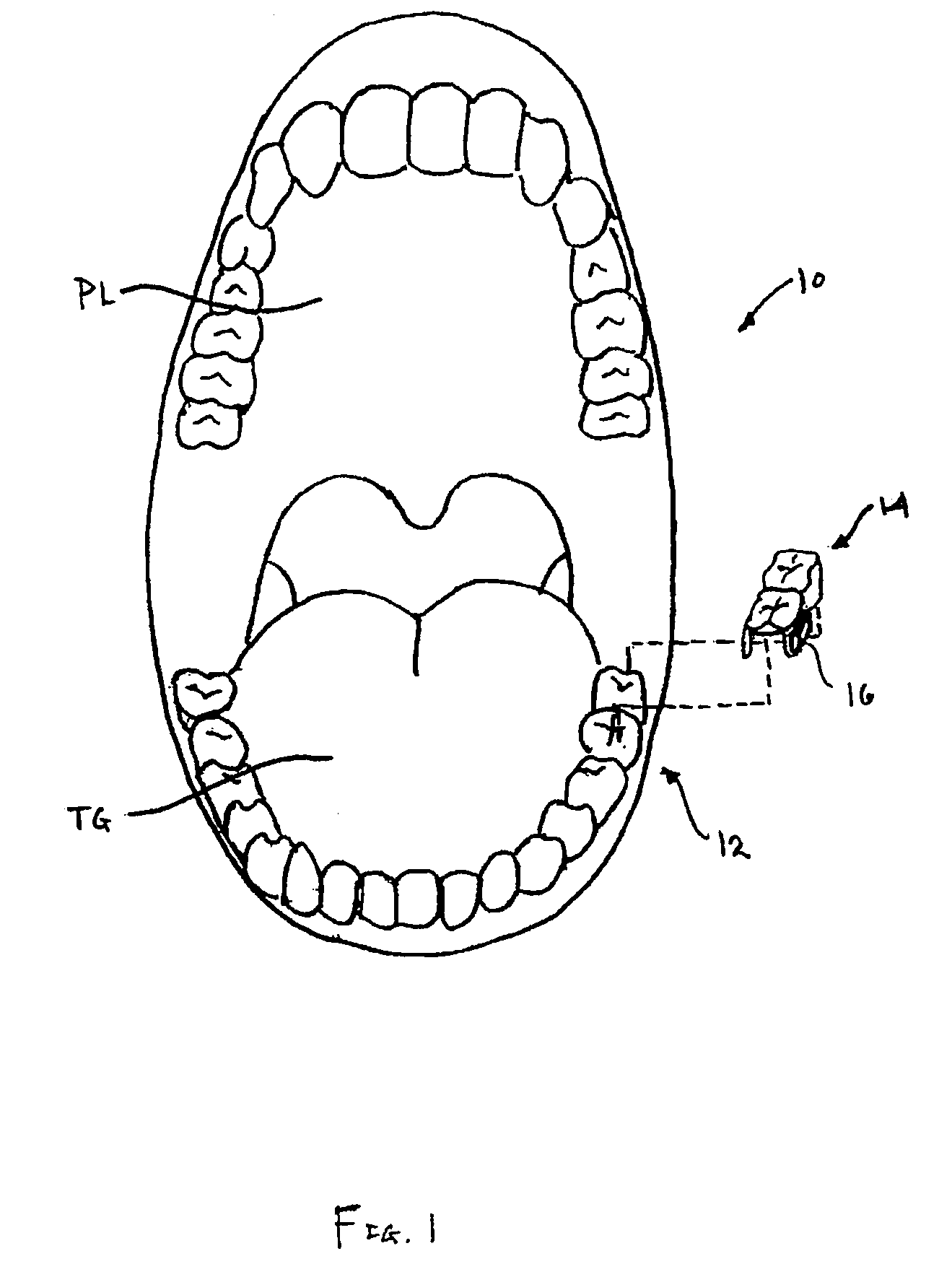 Methods and apparatus for processing audio signals