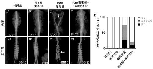 Application of baicalin in the preparation of drugs for preventing neural tube defects in fetuses with gestational diabetes mellitus