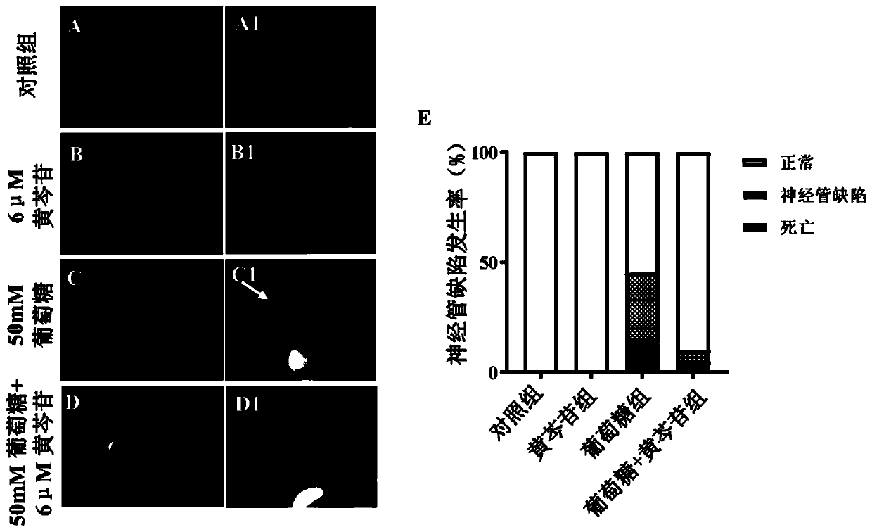 Application of baicalin in the preparation of drugs for preventing neural tube defects in fetuses with gestational diabetes mellitus