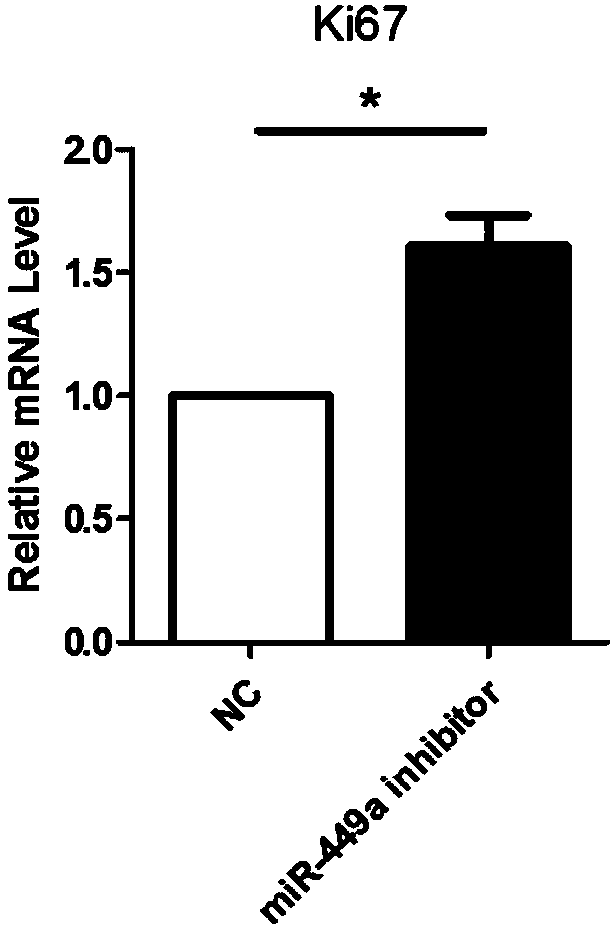 Method for promoting in-vitro amplification of RPCs (retinal progenitor cells) of mouse by inhibiting microRNA (micro ribonucleic acid)