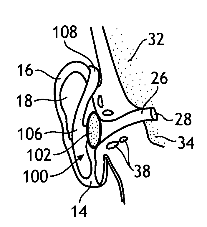 Clip-style hearing protector