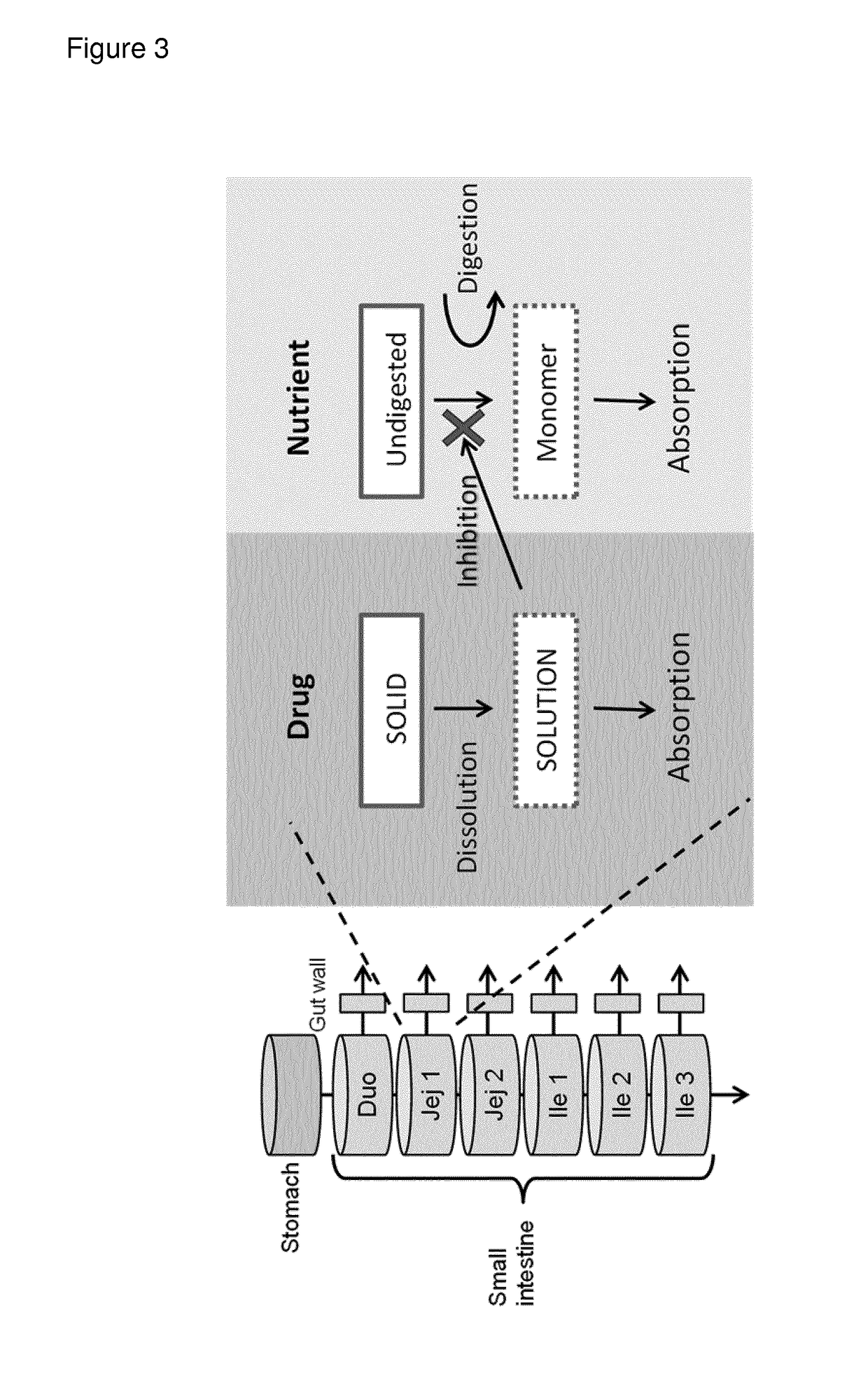 Modified release composition of orlistat and acarbose for the treatment of obesity and related metabolic disorders