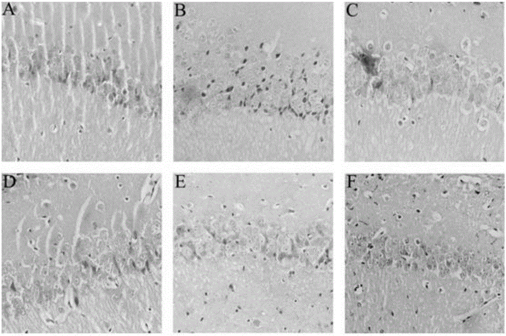 Application of gentiopicroside used as medicine for preventing and treating epileptic attack and cerebral injury