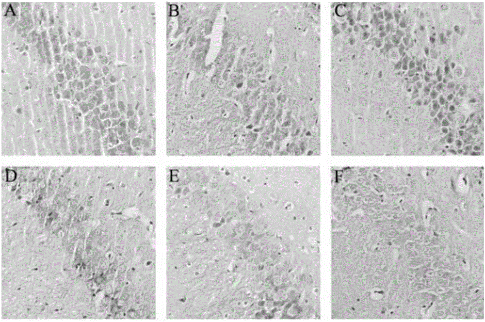 Application of gentiopicroside used as medicine for preventing and treating epileptic attack and cerebral injury