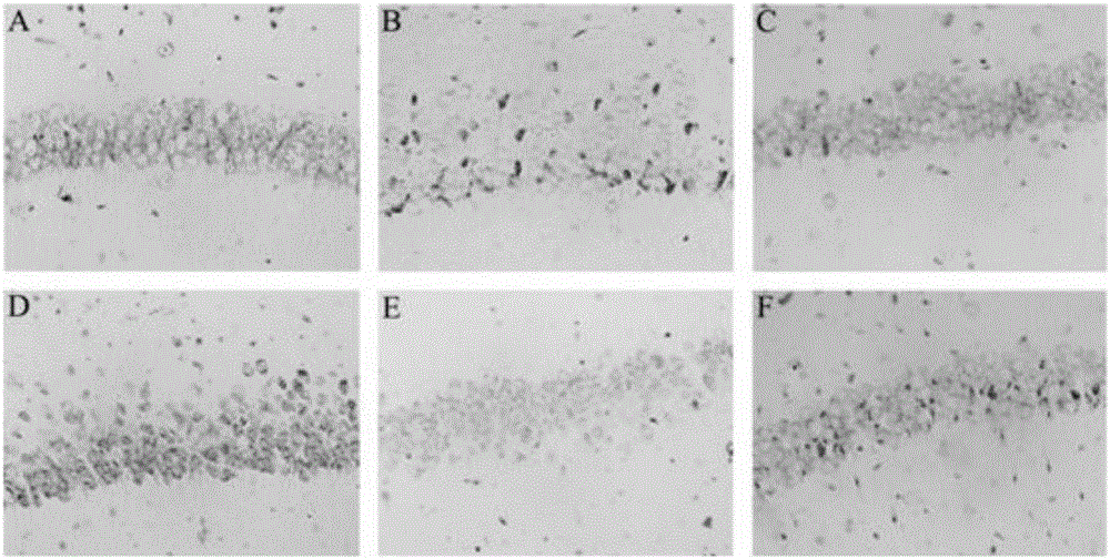 Application of gentiopicroside used as medicine for preventing and treating epileptic attack and cerebral injury