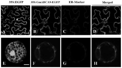 Soybean lipid transporter gene GmABCA9 and application thereof