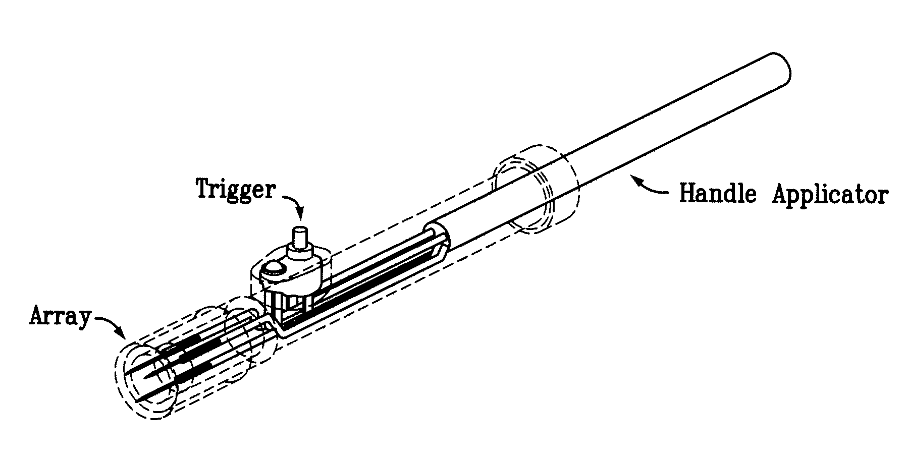 Electroporation devices and methods of using same for electroporation of cells in mammals