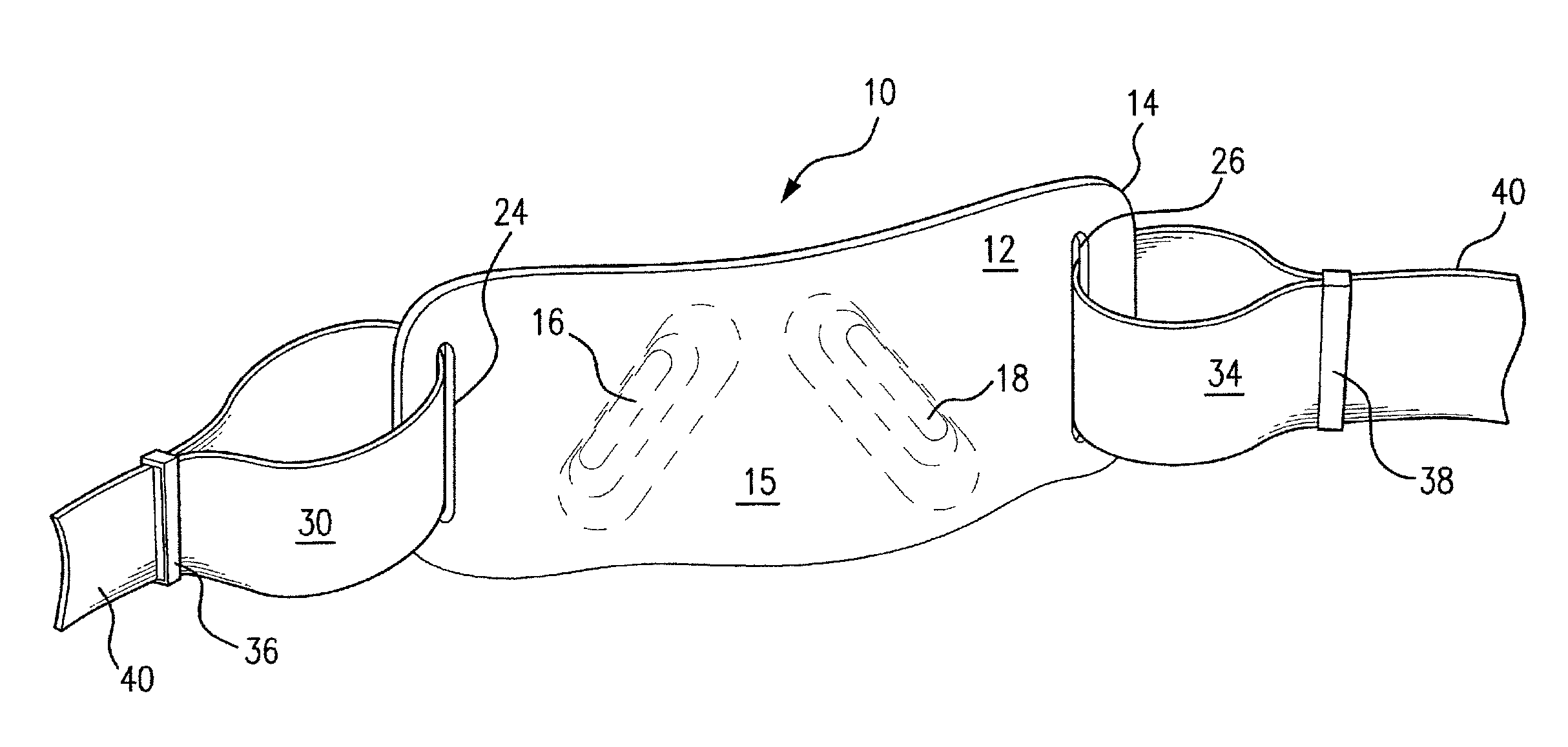 Anti-reflux/heartburn treatment device