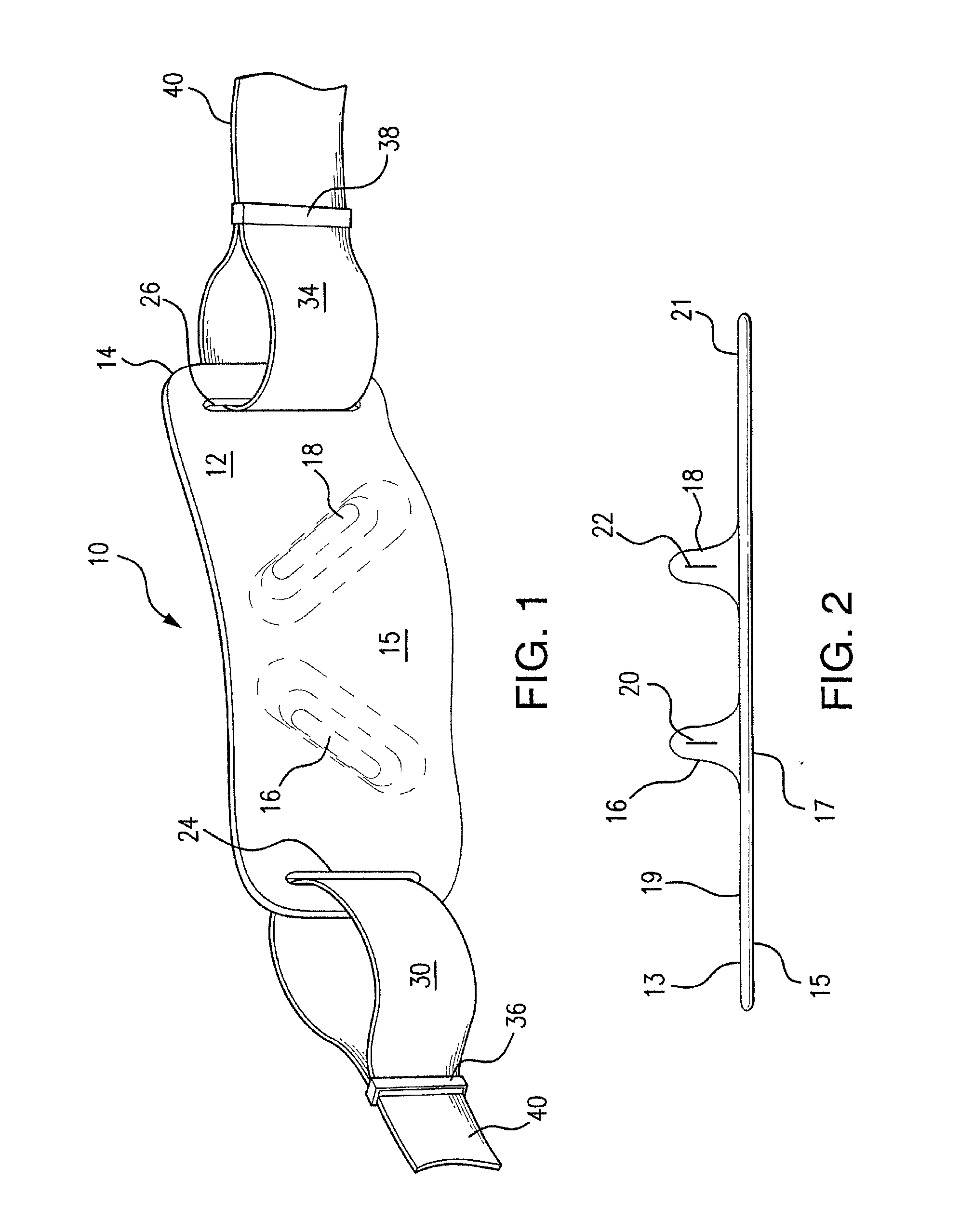 Anti-reflux/heartburn treatment device