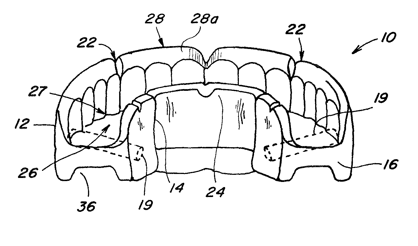 Dental bite construction for performance enhancing mouth guards