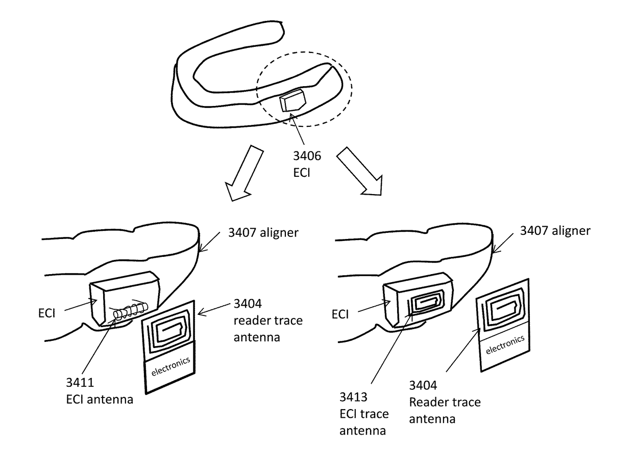 Intraoral appliances with sensing