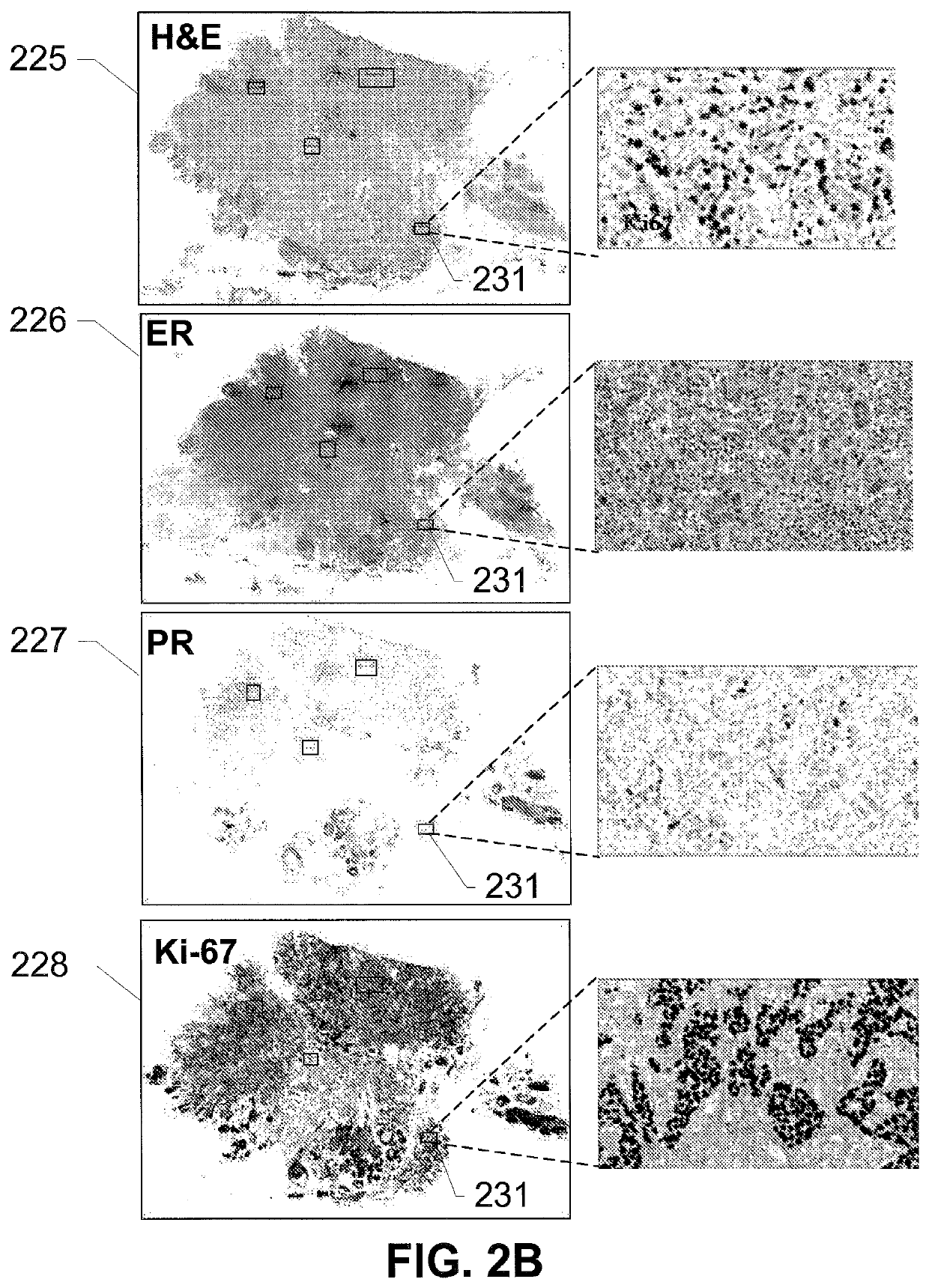 Cancer risk stratification based on histopathological tissue slide analysis