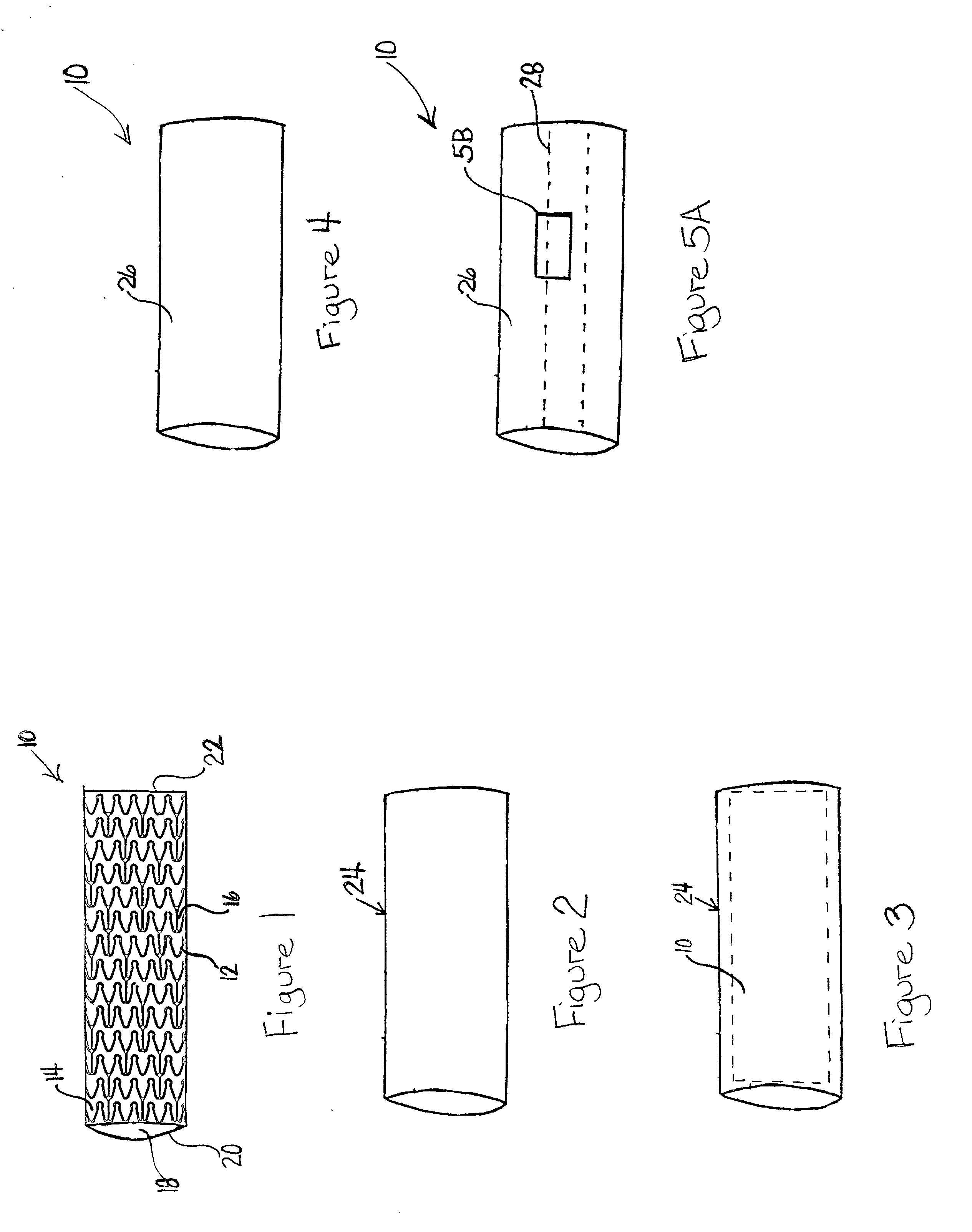 Methods of forming a coating for a prosthesis