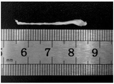 A nerve substrate catheter for nerve repair and its preparation method