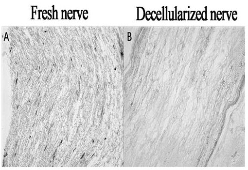 A nerve substrate catheter for nerve repair and its preparation method