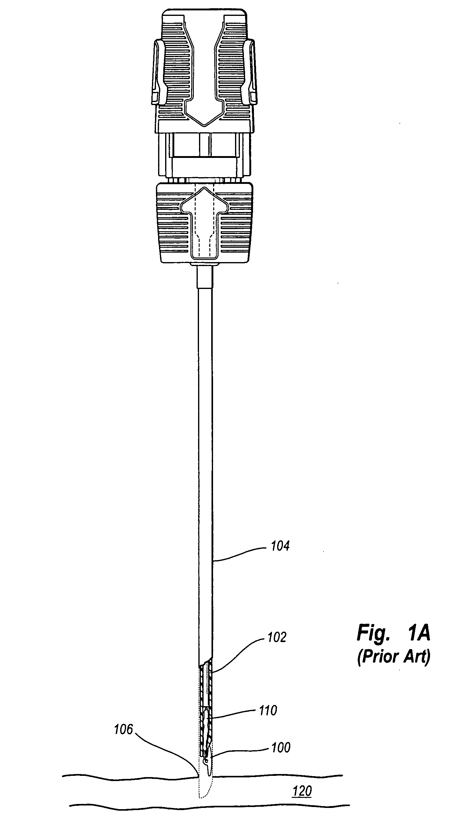 Arteriotomy closure device with anti-roll anchor